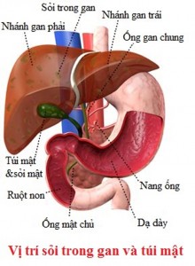 bệnh sỏi gan