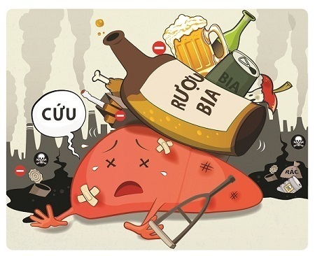 bệnh sỏi gan có nguy hiểm không