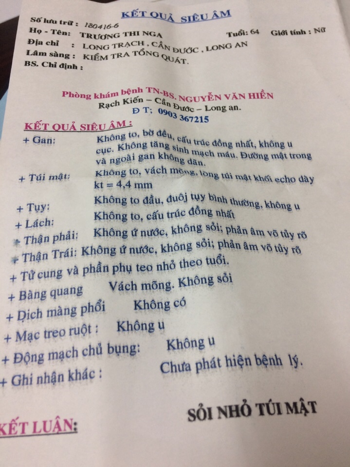 giảm sỏi mật
