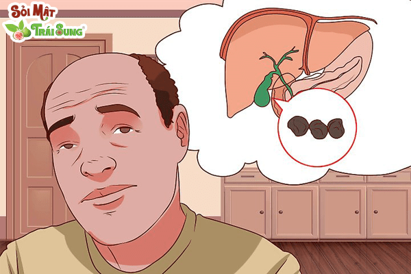 cách làm tan sỏi