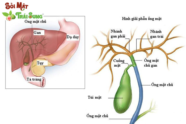 cách điều trị sỏi mật hiệu quả