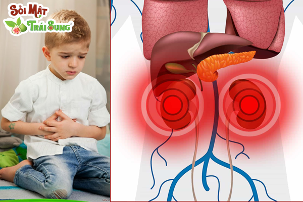 dấu hiệu sỏi thận ở trẻ em