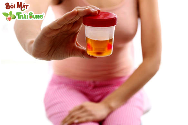 triệu chứng bệnh sỏi thận