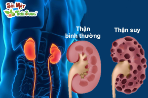Các giai đoạn của bệnh suy thận