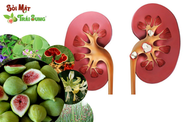 chữa sỏi thận bằng đu đủ