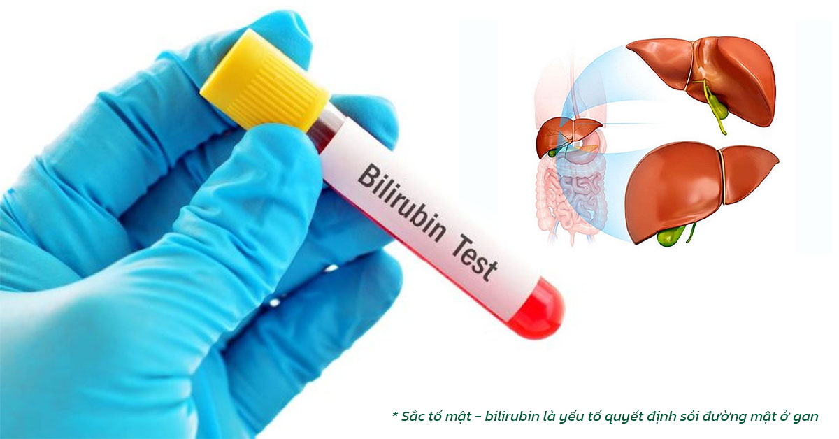 Sắc tố mật - bilirubin là yếu tố quyết định sỏi đường mật ở gan