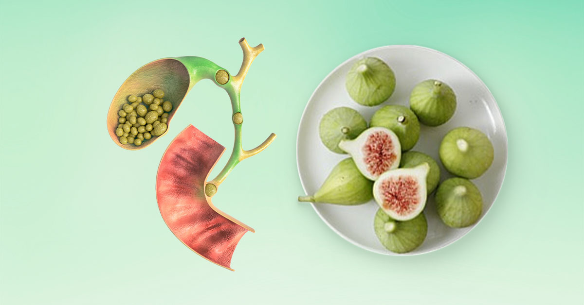 Quả sung là nguyên liệu chữa sỏi mật hiệu quả Quả sung là nguyên liệu chữa sỏi mật hiệu quả