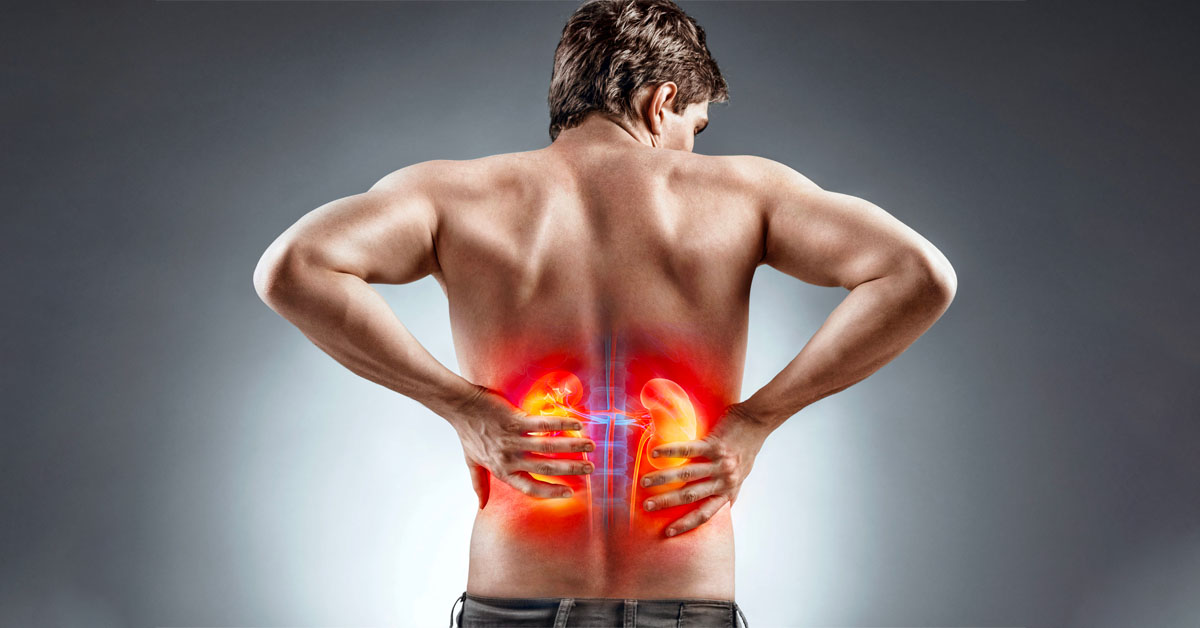 Sỏi thận gây đau ở một bên hoặc hai bên thận tuỳ thuộc vào vị trí của sỏi Sỏi thận gây đau ở một bên hoặc hai bên thận tuỳ thuộc vào vị trí của sỏi