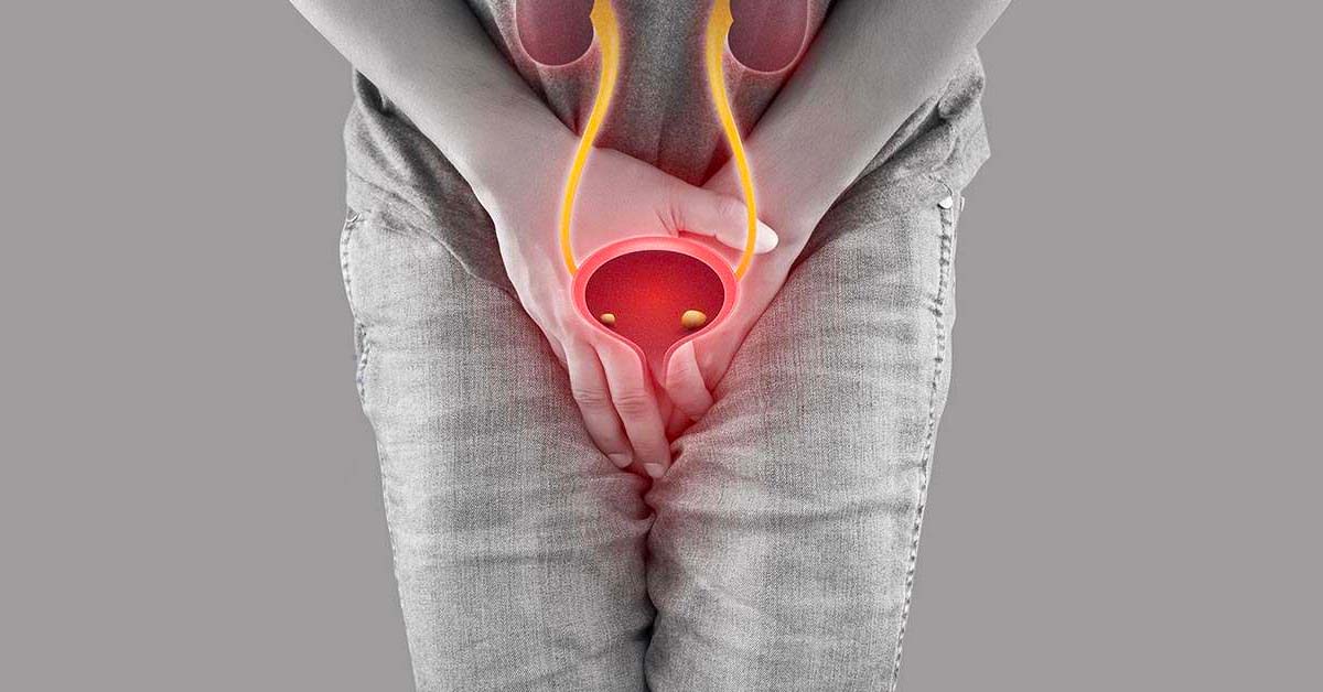 Sỏi rơi xuống niệu đạo gây các cơn đau quặn thận 