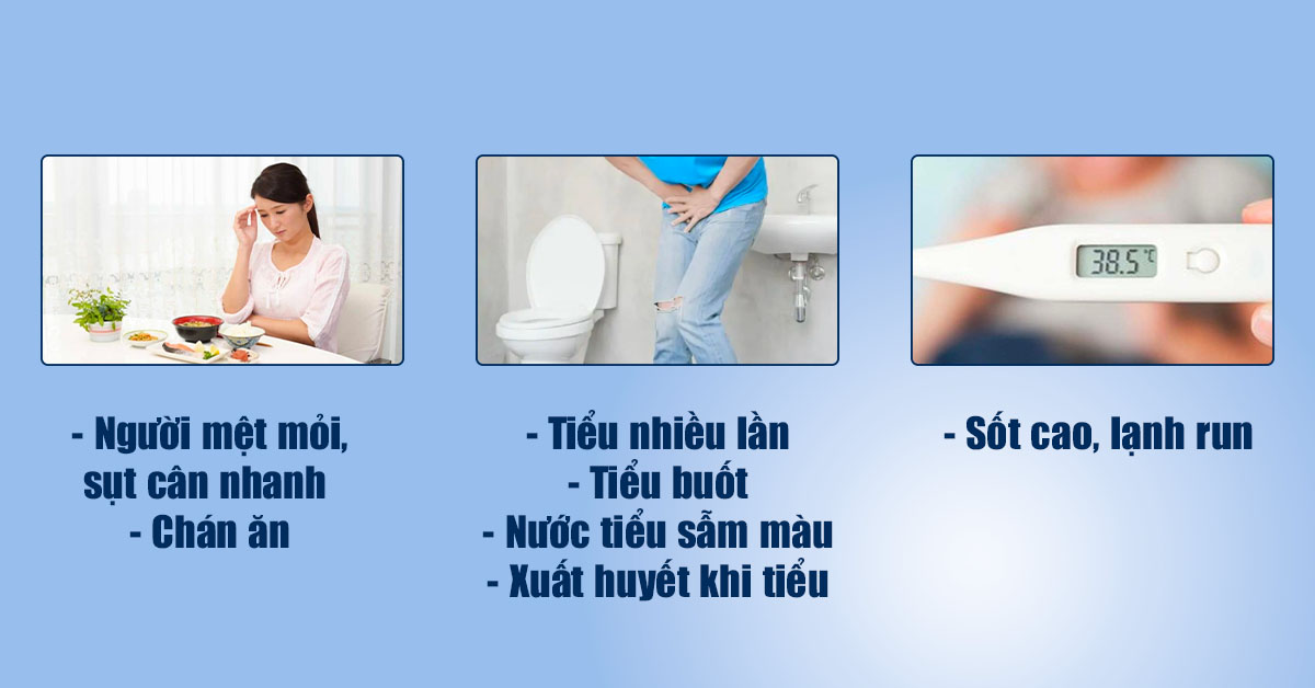 Biểu hiện thường gặp của sỏi san hô