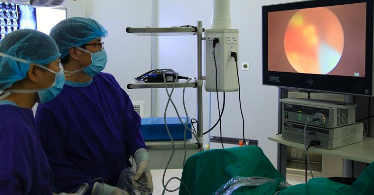 Phẫu thuật lại bỏ sỏi là giải pháp hàng đầu khi mắc sỏi thận san hô