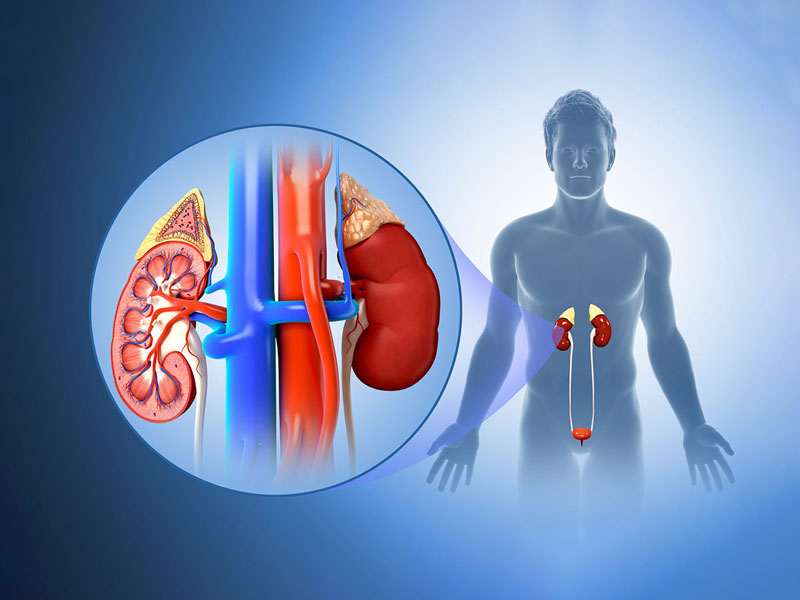  Sỏi thận là bệnh lý nguy hiểm của hệ tiết niệu 