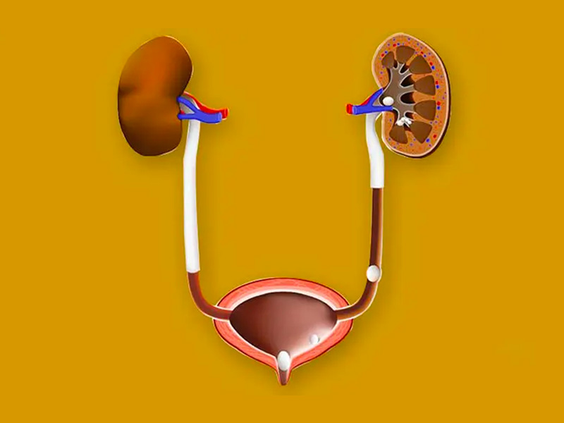 Điều trị sỏi bàng quang triệt để giúp bàng quang thực hiện tốt chức năng co bóp đẩy nước tiểu ra ngoài