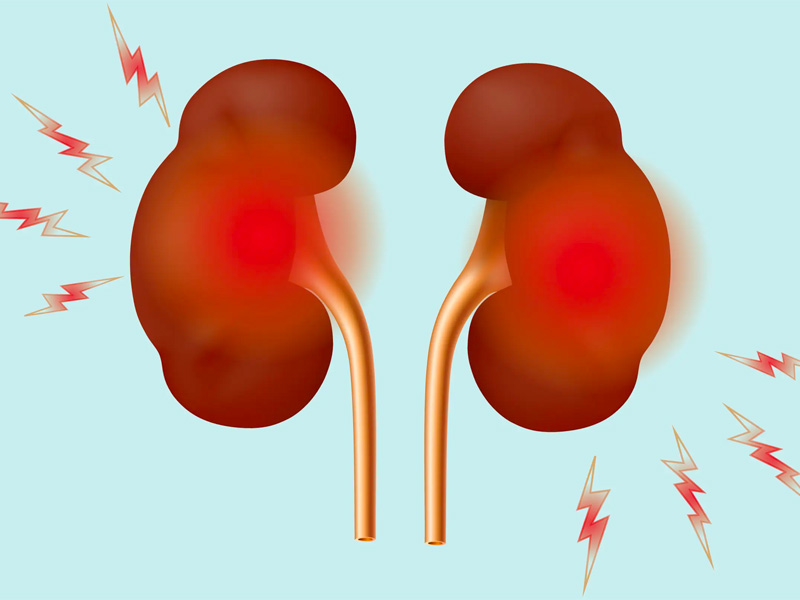 Biến chứng của cặn thận