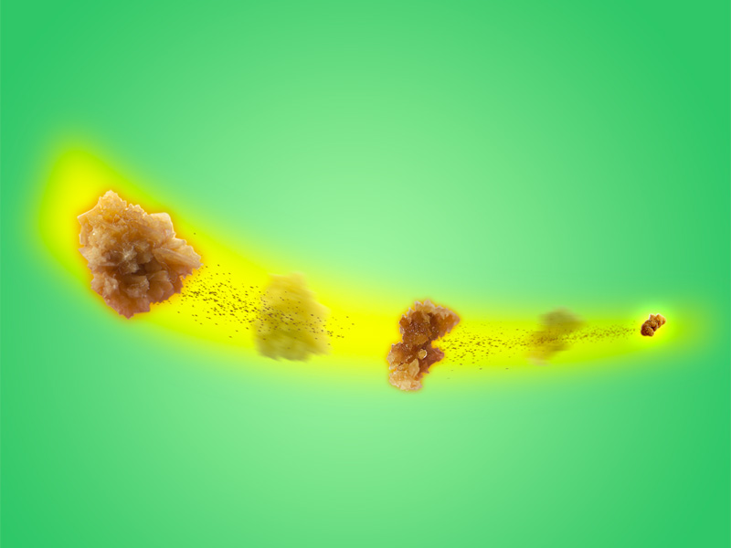 Sỏi thận tăng nhanh về kích thước nếu cơ thể thiếu canxi 