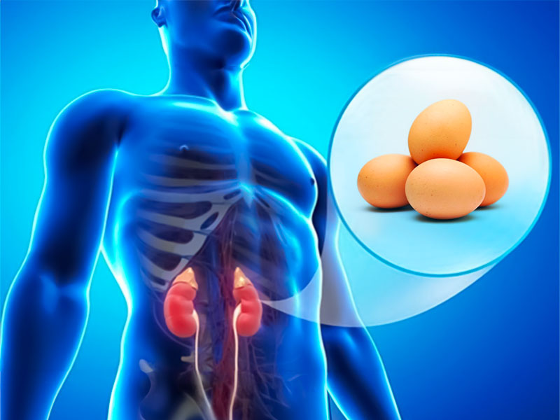  Ăn trứng có bị sỏi thận không?