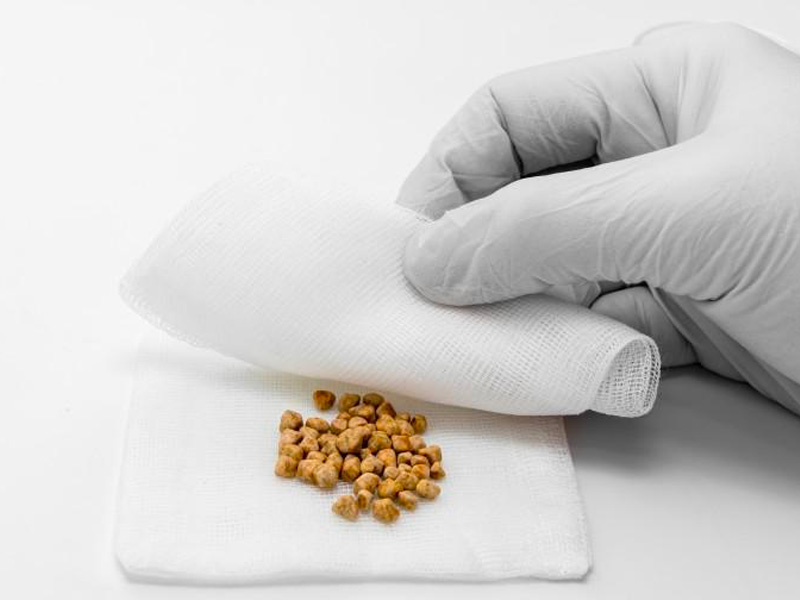 Thời gian để sỏi thận đào thải là bao lâu?