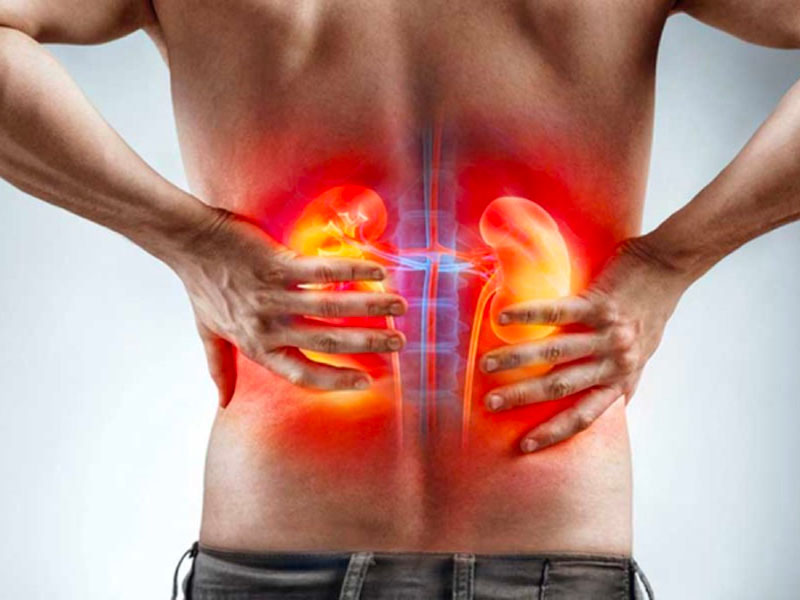 Đau do sỏi tiết niệu và đau lưng do xương khớp hoàn toàn khác nhau