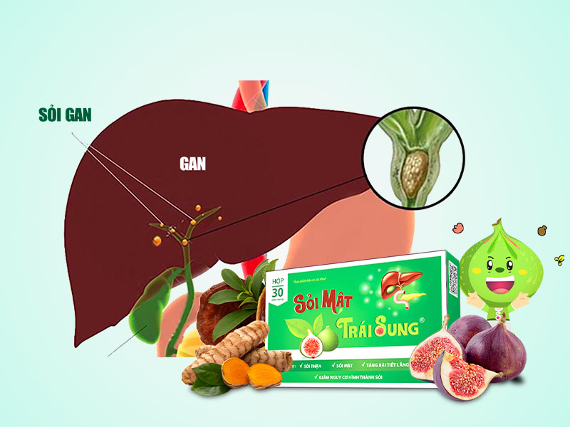 Điều trị sỏi đường mật trong gan nhờ sử dụng sỏi mật trái sung