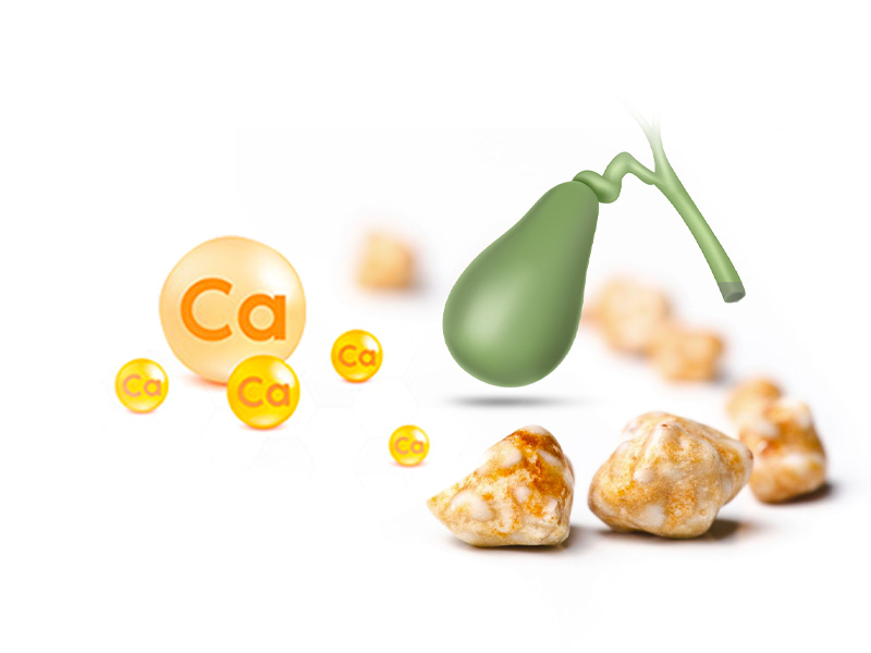  Bị sỏi mật có uống được canxi không?