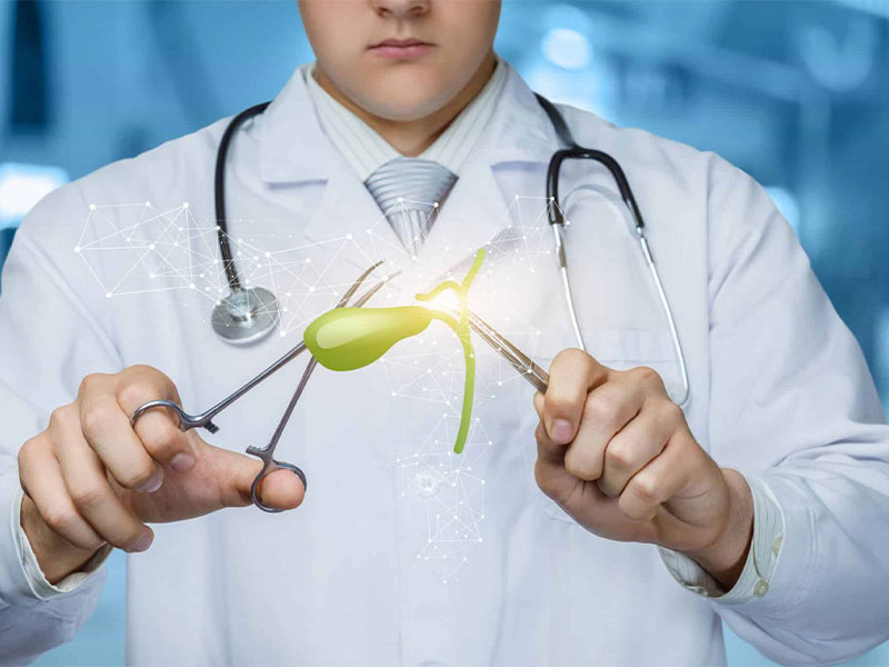 Điều trị sỏi bùn mật có triệu chứng ra sao?