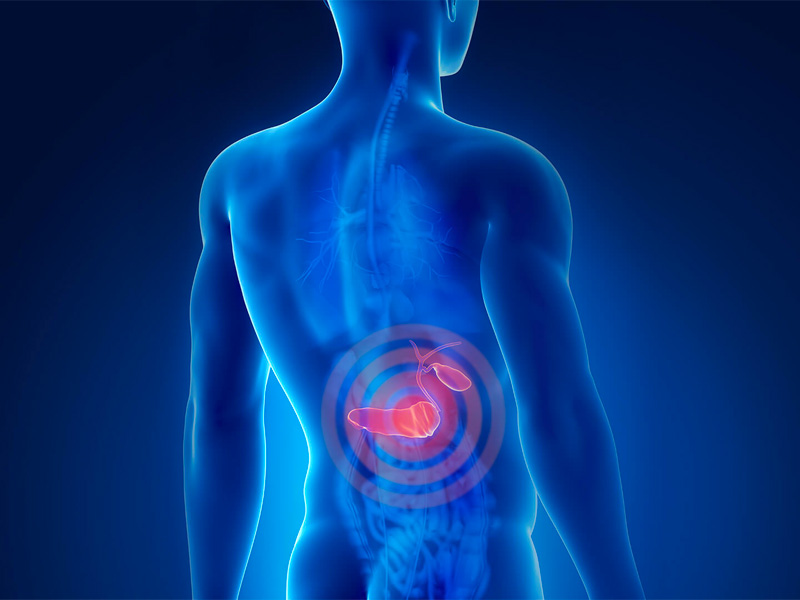 Tại sao sỏi mật gây đau lưng?