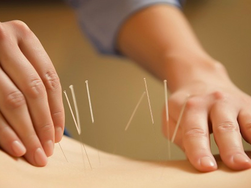 Giảm cơn đau sỏi mật bằng phương pháp châm cứu