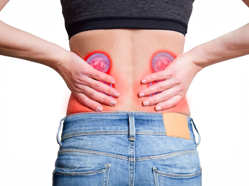 Sỏi thận gây đau lưng tập trung vùng quanh thận