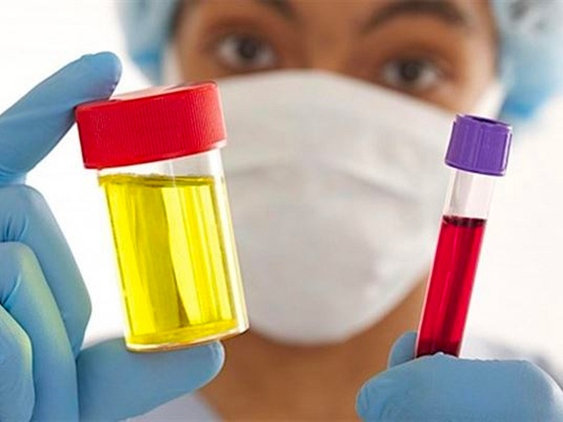 Sỏi thận tiểu ra máu phải xử lý ra sao?