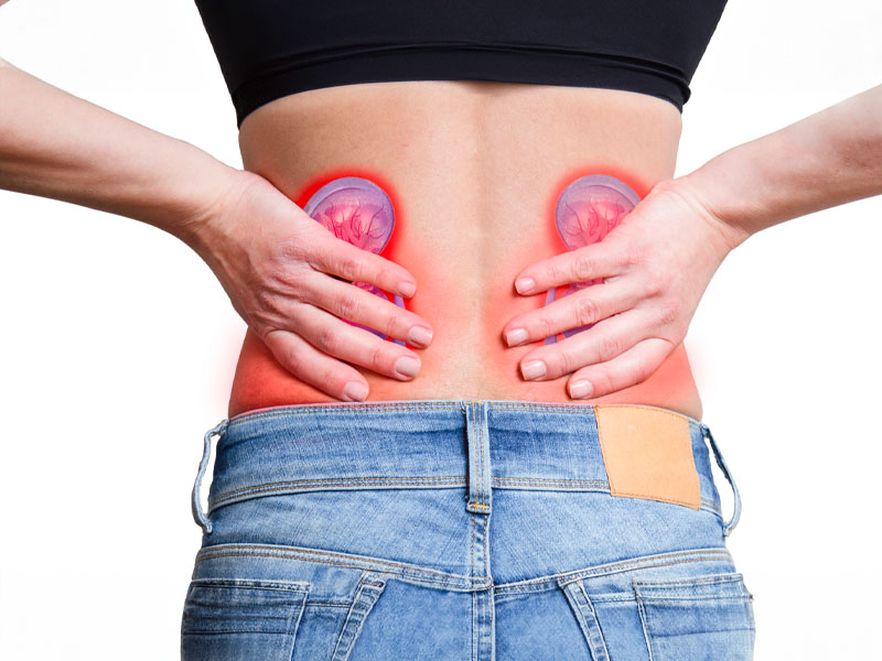  Sỏi thận gây đau vùng thắt lưng lan xuống bộ phận sinh dục