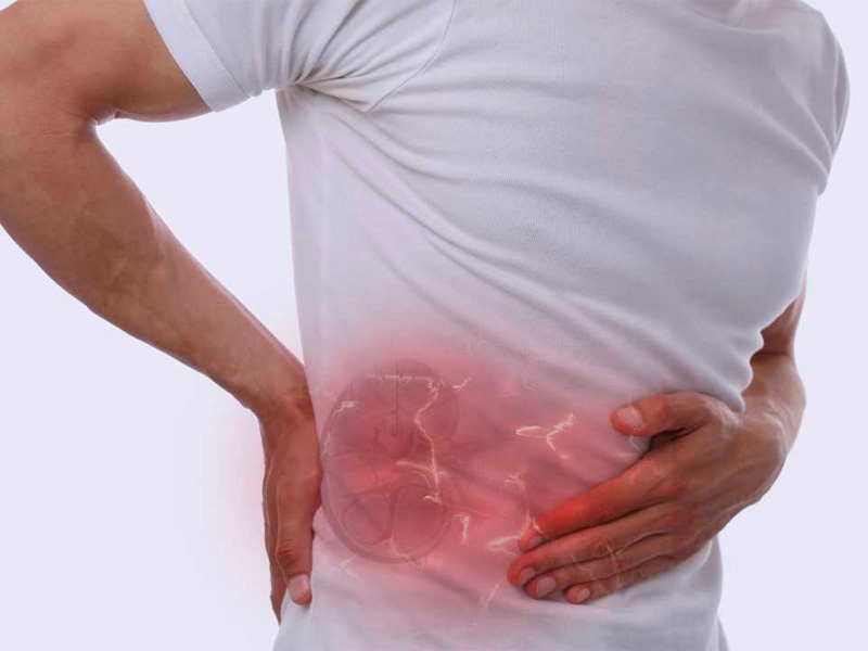 Bị sỏi thận có đau lưng không?