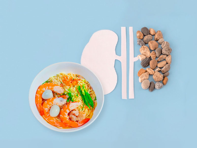 Bị sỏi thận có nên ăn mì tôm không?
