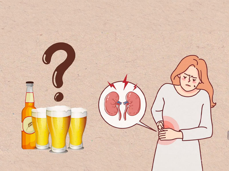  Bị sỏi thận có nên uống bia không?