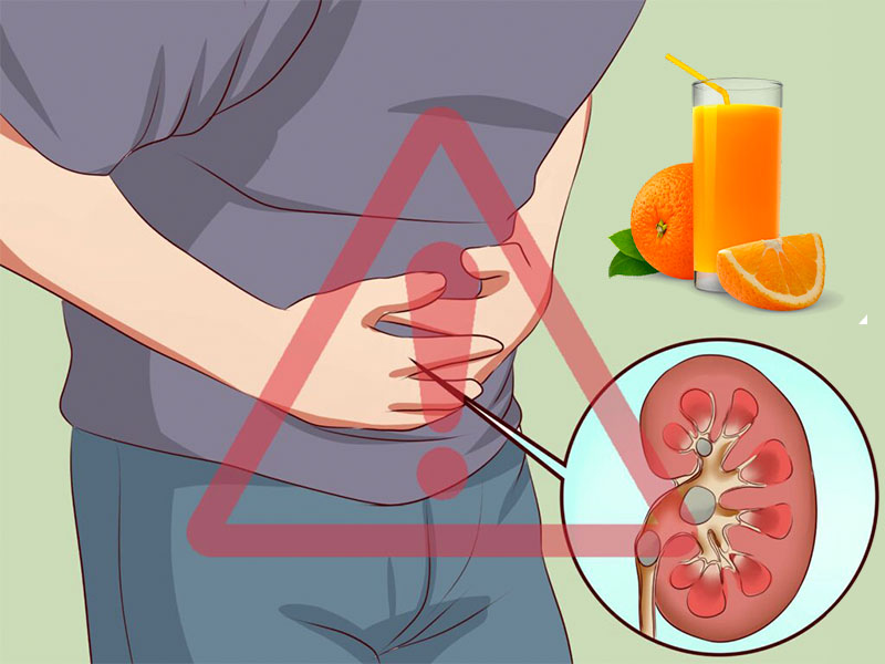 Bị sỏi thận có nên uống nước cam không?