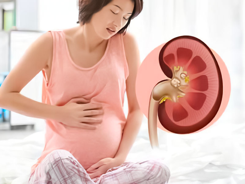 Bị sỏi thận có thai được không?