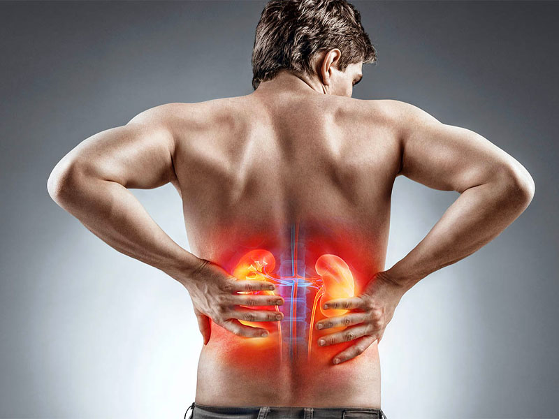  Đau tức vùng thận, lan ra sau lưng, xuống bộ phận sinh dục là triệu chứng của bệnh sỏi thận 