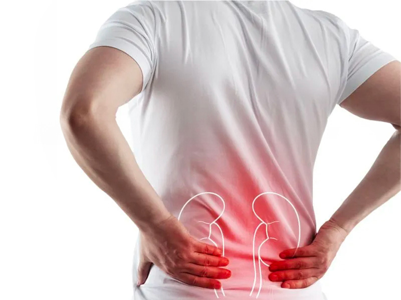  Đau lưng dữ dội do sỏi thận gây ra
