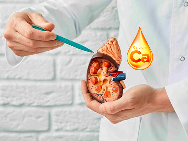 3 Loại canxi nào uống không bị sỏi thận?