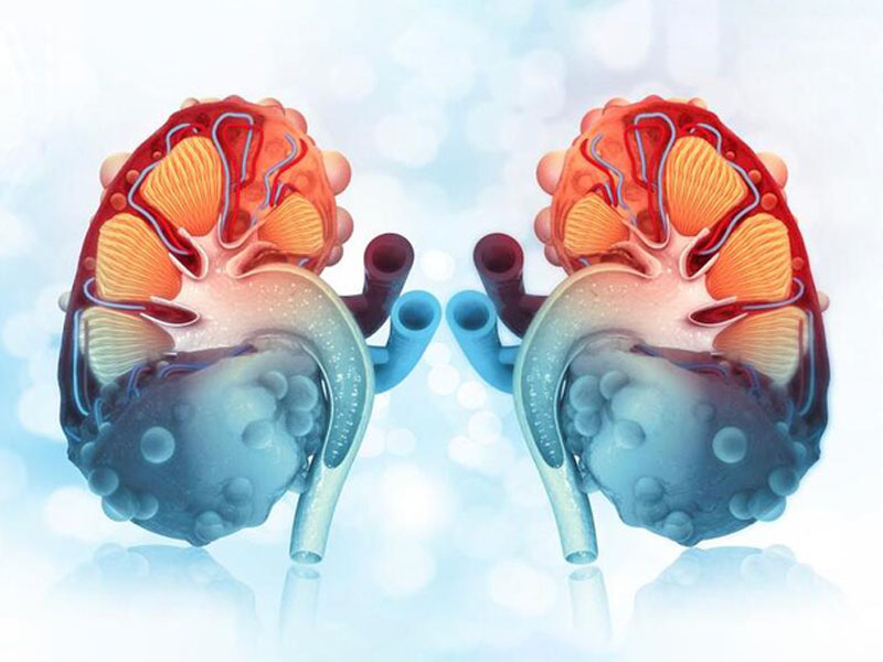 Chẩn đoán bệnh thận đa nang đóng vai trò rất quan trọng