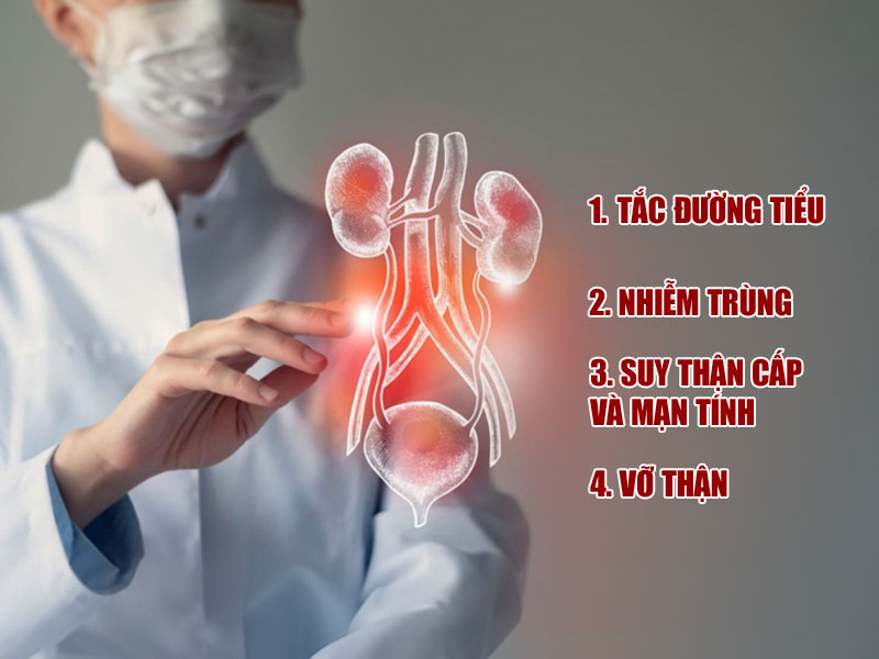 Cẩn thận trước những biến chứng do sỏi thận gây ra