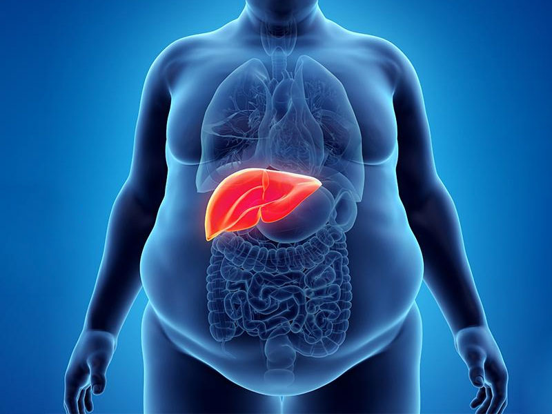 Cách trị gan nhiễm mỡ độ 1 tại nhà 