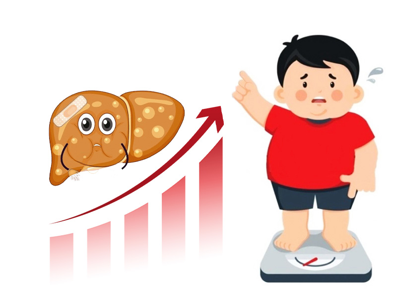Bệnh gan nhiễm mỡ ở trẻ em ngày càng tăng cao