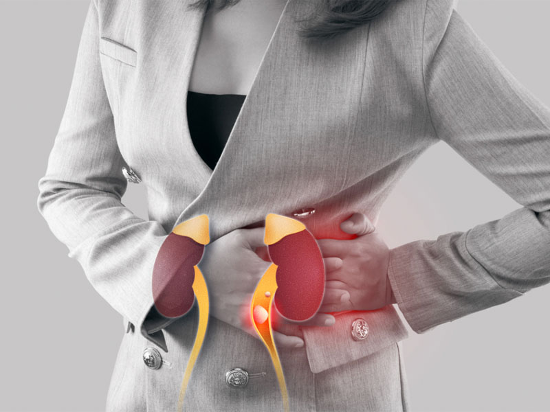 Sỏi niệu quản có tiệu chứng đau tập trung ở vùng thắt lưng và hai bên hông