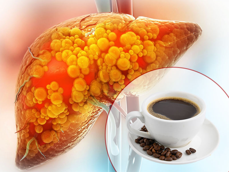 Bệnh gan nhiễm mỡ có uống được cà phê không?