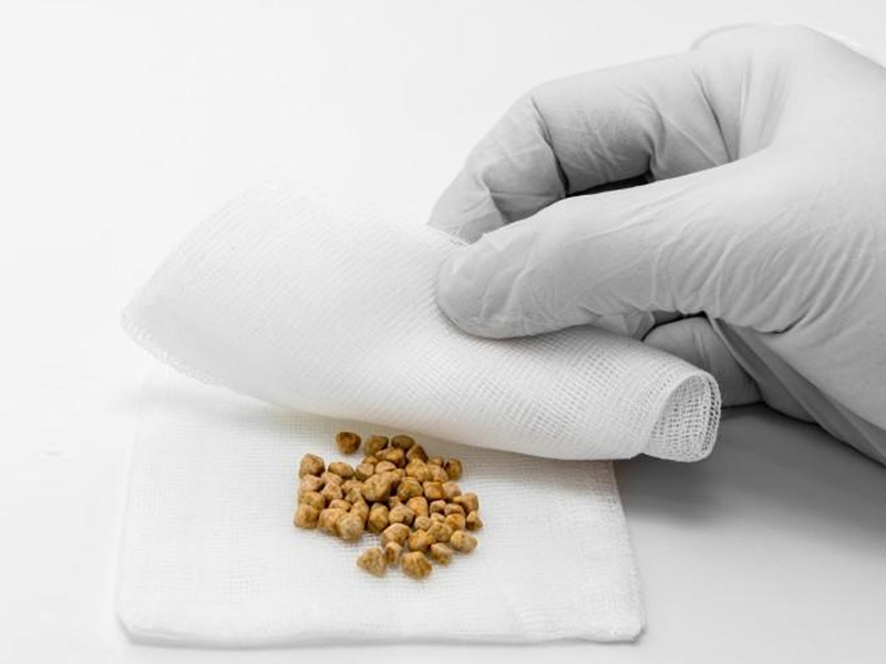 Kích thước sỏi thận quyết định khả năng tự đào thải hay can thiệp dùng thuốc để điều trị