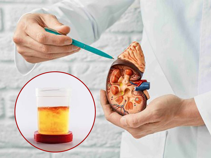 Điều trị sỏi thận tiểu ra máu cần dựa vào tình trạng người bệnh để có phác đồ phù hợp 