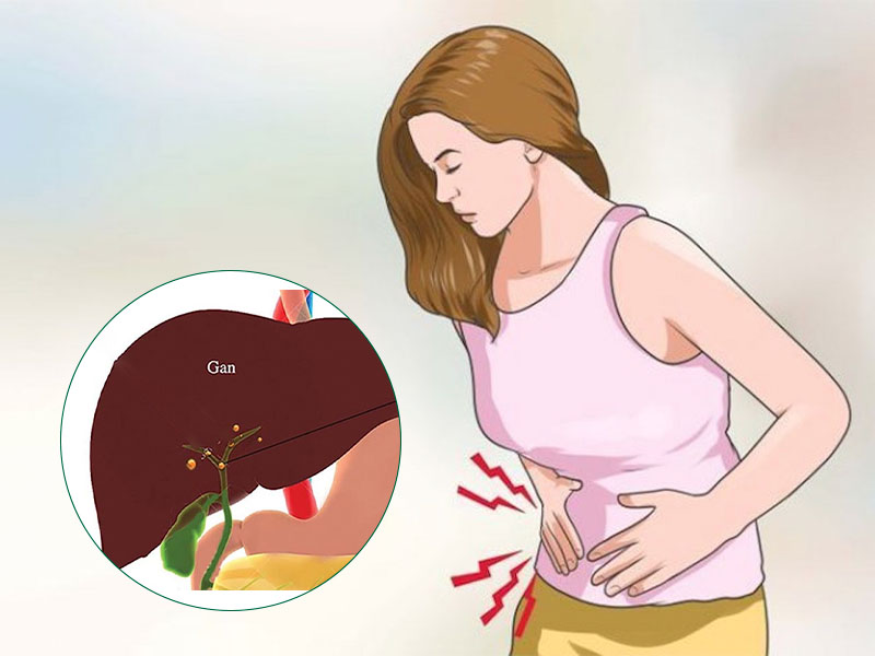 Sỏi gan cần được phát hiện sớm để có phác đồ điều trị thích hợp hạn chế biến chứng nguy hiểm