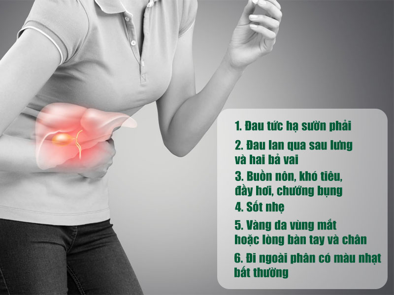  6 biểu hiện thường gặp của sỏi bùn mật đã tiến triển nặng thành sỏi mật 