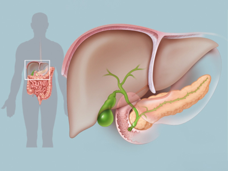 Chức năng gan, mật bị rối loạn làm tăng nguy cơ mắc polyp mật