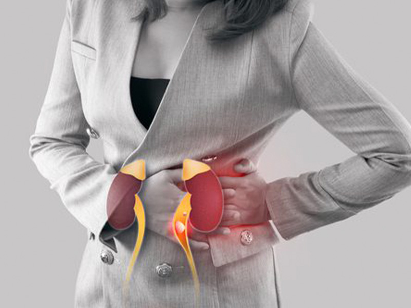 Nhân viên văn phòng có một trong những đối tượng có nguy cơ bị sạn thận cao